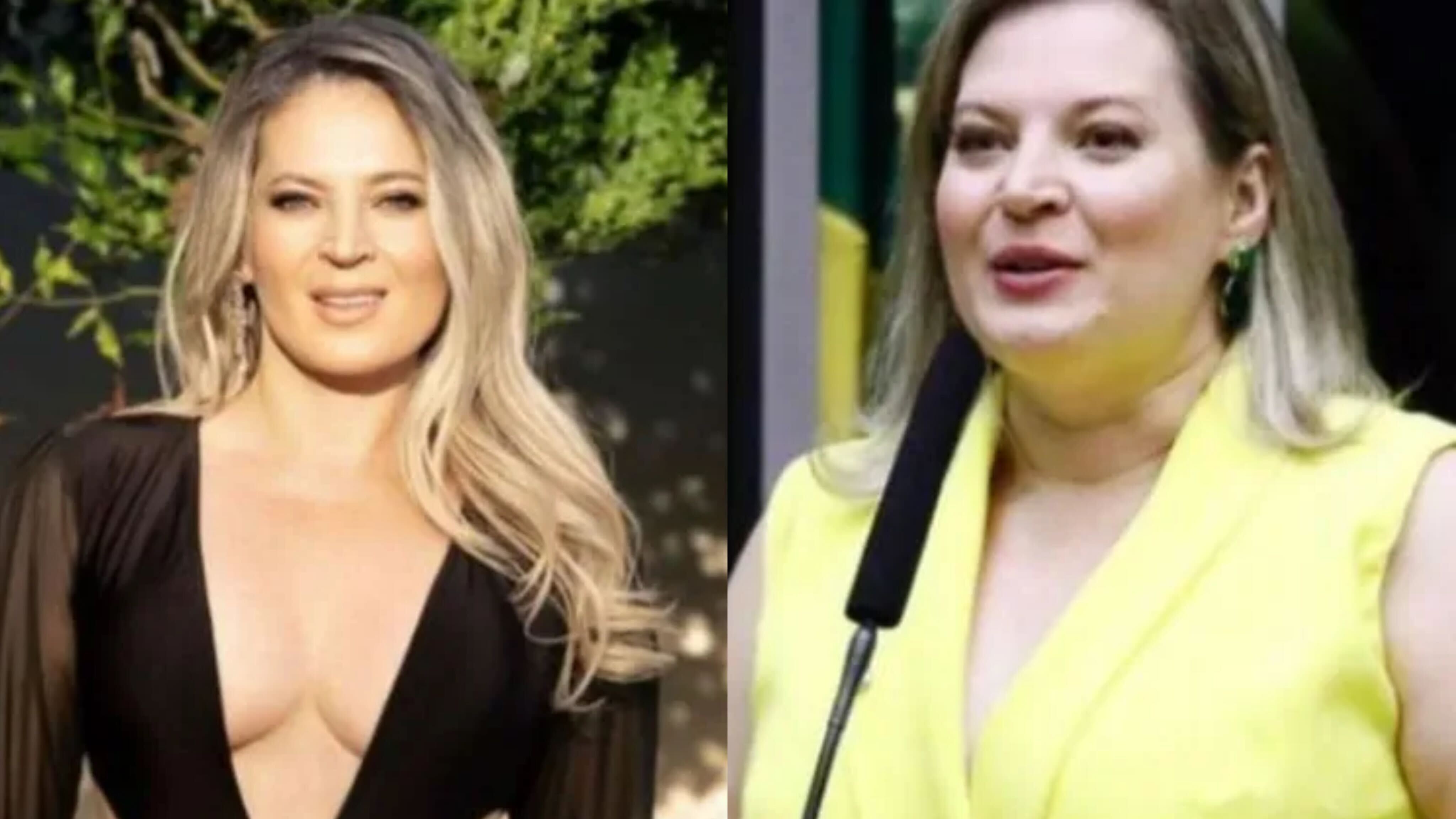 Confira o antes e depois da ex-deputada Reprodução Instagram - 9.4.2024