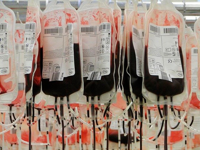 Por causa da pandemia, em 2020, o registro de doações tinha caído cerca de 10% no Brasil. Foram 2,9 milhões de doações, segundo o Ministério da Saúde.  Daí a importância ainda maior das campanhas de conscientização.  Reprodução: Flipar