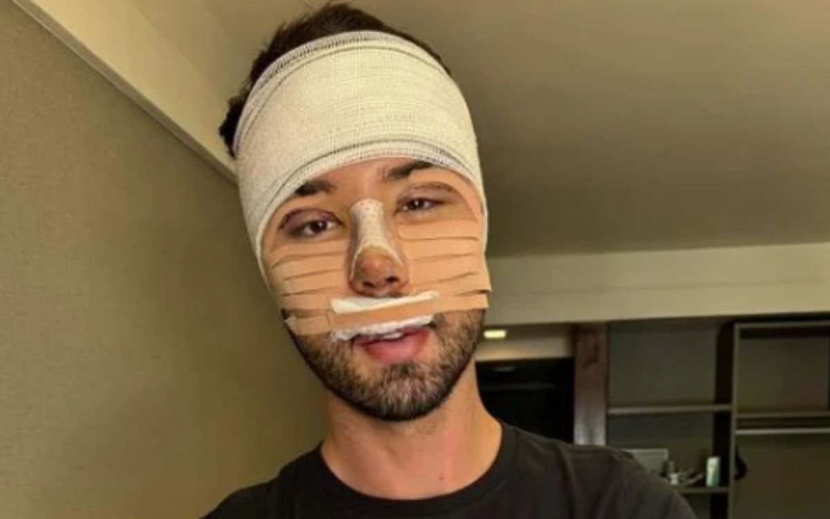 Rico Melquíades e sua mudança de visual. Foto: Facebook