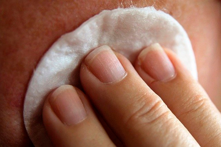 Remova a maquiagem antes de dormir. A higiene e limpeza da pele reduzem o risco de acne e cravos, atenua a oleosidade e age como antioxidante, prevenindo o envelhecimento da pele.  Reprodução: Flipar