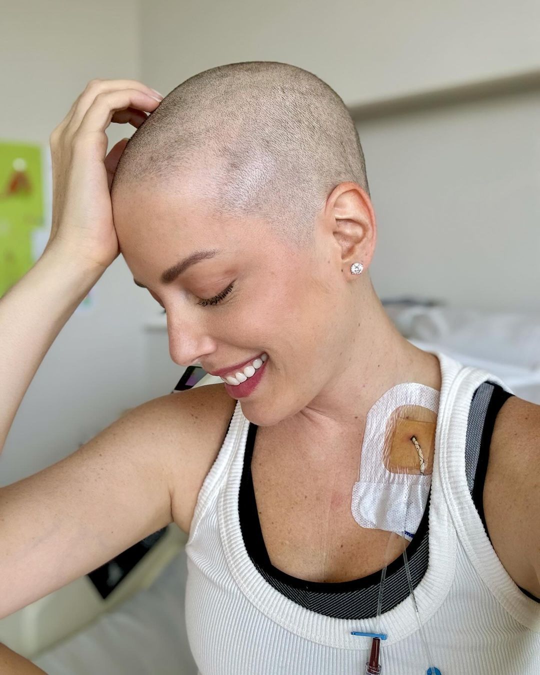 Fabiana Justus raspa o cabelo durante tratamento contra o câncer Reprodução/Instagram - 09.02.2024