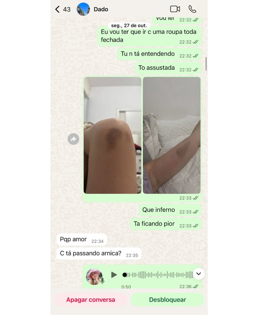 Marcela Tomaszewski postou prints e fotos de supostas agressões. Foto: Reprodução/ Instagram @tomaszewsk