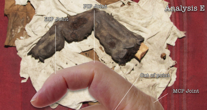 Análise de dedo mumificado em 2017 Reprodução