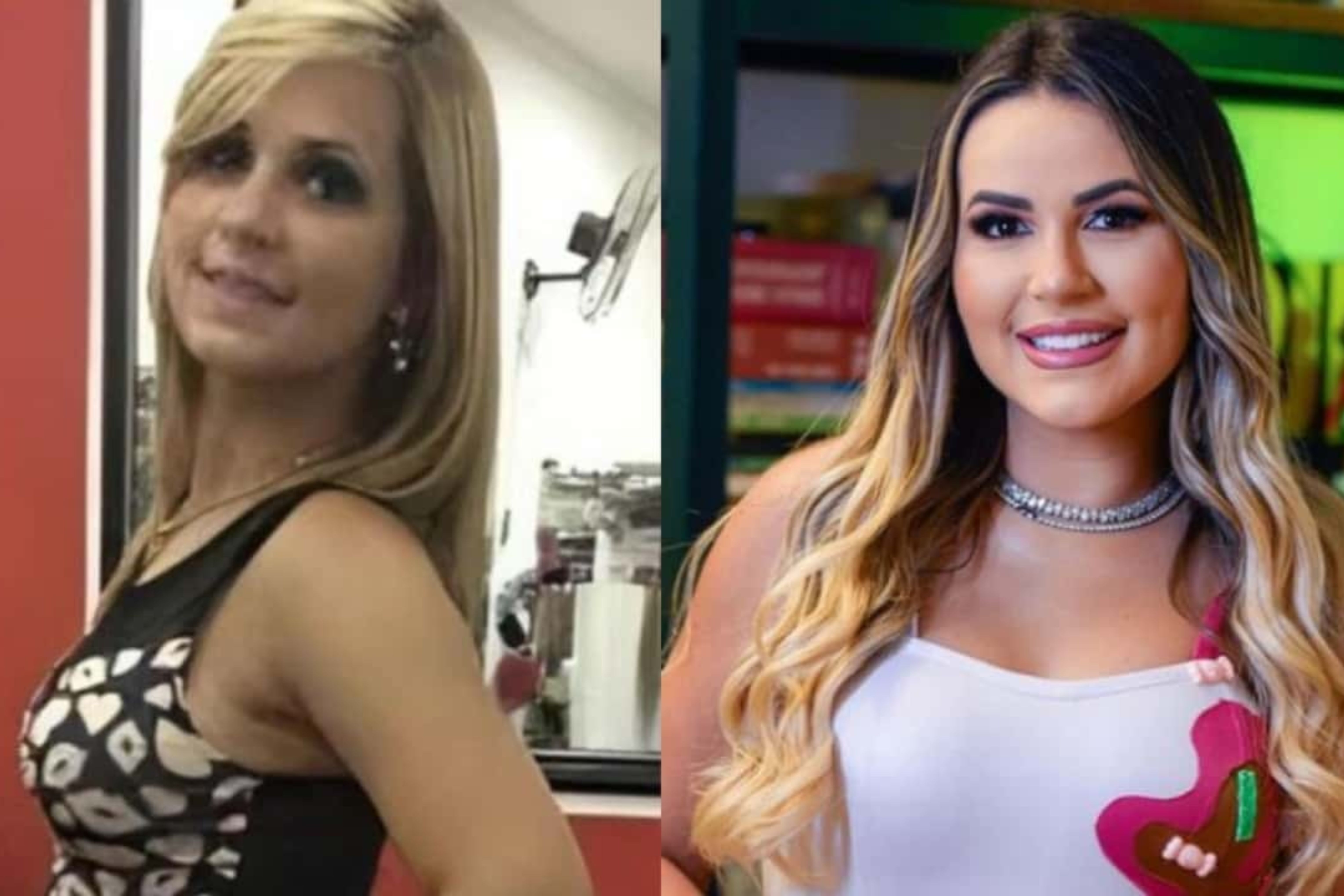 Antes e depois de Deolane Bezerra Reprodução