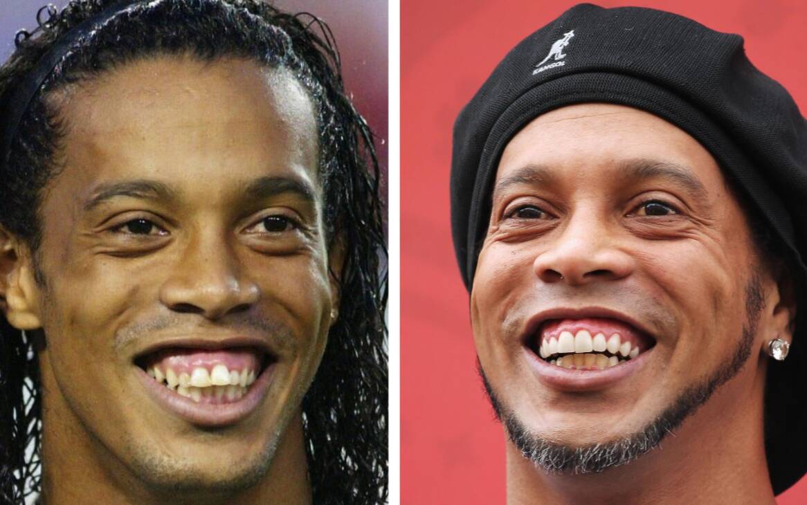 10 - Ronaldinho. Foto: Reprodução