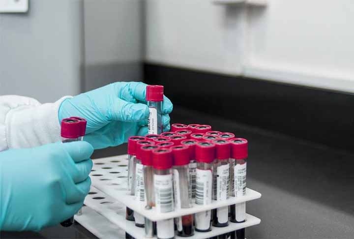 Elas também atuam na redução dos níveis de colesterol LDL, também conhecido como o colesterol “ruim” e
ajudam a regular os níveis de açúcar no sangue, fator importante para quem possui quadro de diabetes, sobretudo a mellitus (tipo 2).
 Reprodução: Flipar