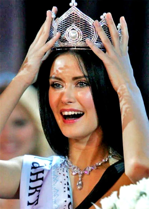 Sofia Rudieva (2009) - A Miss Rússia balançou no cargo quando fotos eróticas dela vazaram na imprensa. Mas, ainda assim, ela pôde participar do Miss Universo.   Reprodução: Flipar