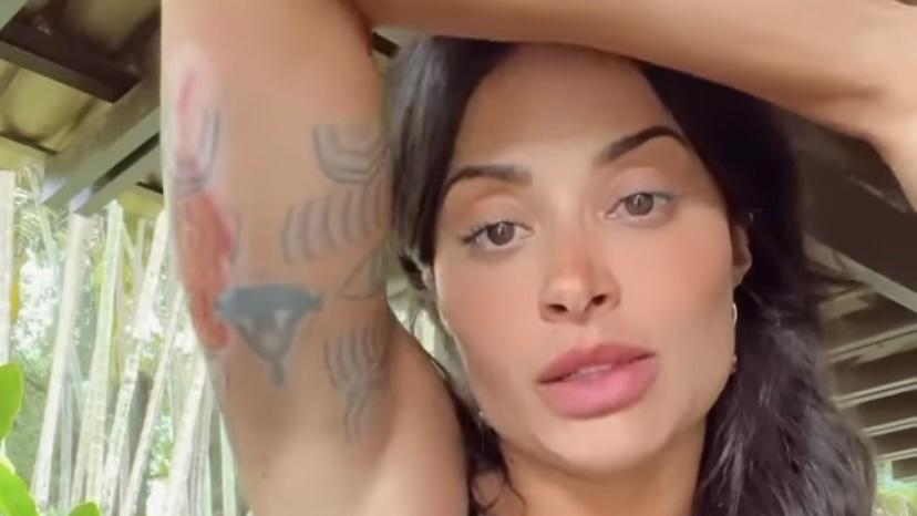 Aline Campos mostra ferimentos após cair de moto com Jesus Luz em Bali. Foto: Reprodução/Instagram