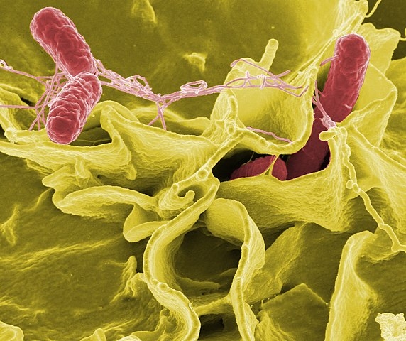 Salmonelose - Causada pela bactéria Salmonella spp., é transmitida pelo contato com cães portadores. Os sintomas incluem febre, diarreia e dor abdominal. Reprodução: Flipar