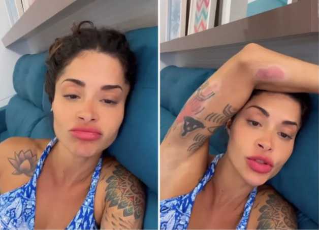 Aline Campos mostra cicatrizes de acidente de moto: ''Vamos viver'. Foto: Foto: Reprodução/Instagram