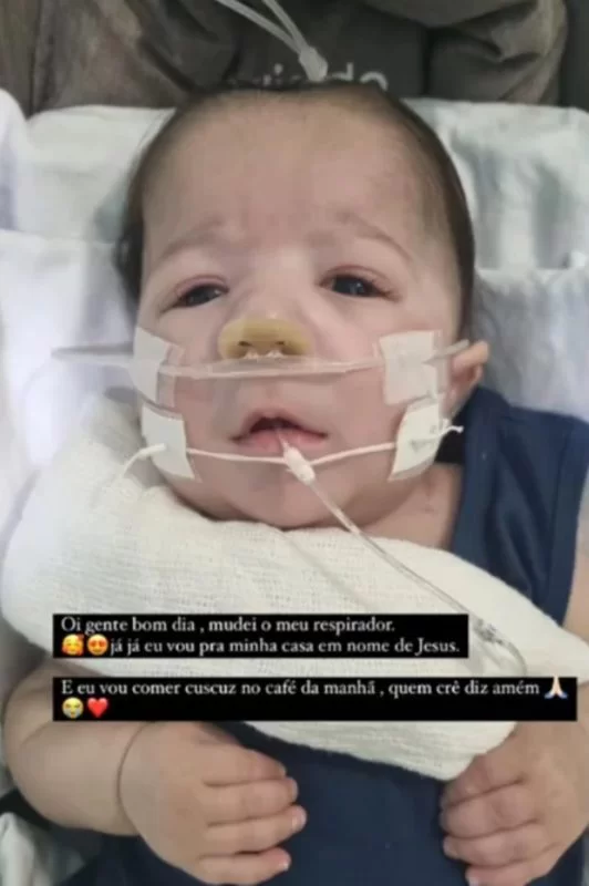 Arthur, filho caçula de Zé Vaqueiro e Ingra Soares, nasceu com Síndrome de Patau, uma malformação congênita, em decorrência da síndrome da trissomia do cromossomo 13 Reprodução/Instagram