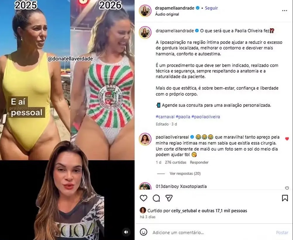 Comentário de Paolla no video da cirurgiã plastica. Foto: Reprodução/Instagram