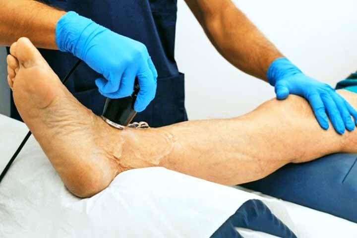 Sean P. Barbabella, médico de Donald Trump, informou que essa condição é comum em adultos com mais de 70 anos, afetando entre 10% e 35% das pessoas nessa faixa etária. Reprodução: Flipar