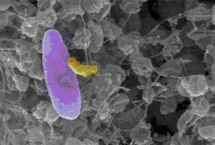 A bactéria Micavibrio aeruginosavorus recebe a alcunha de menor vampiro do mundo, mas é um título positivo. Isso porque ela se alimenta de outras bactérias.  Reprodução: Flipar