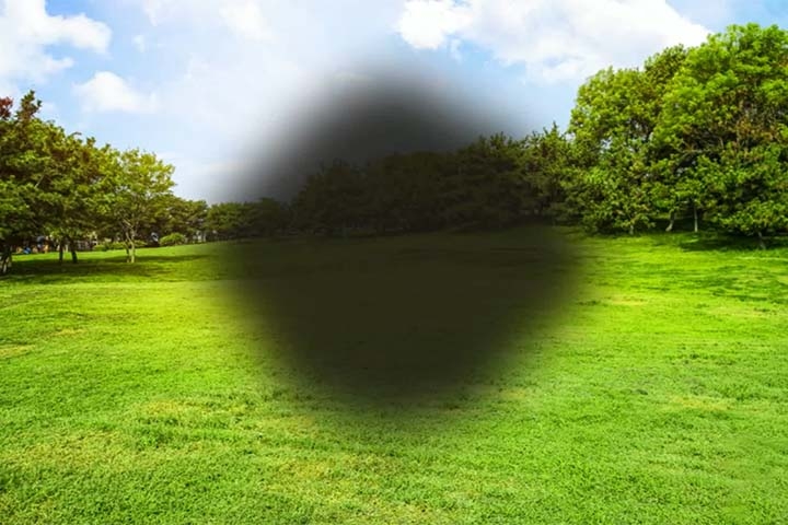 Entre os sintomas mais comuns estão visão embaçada, distorção das linhas retas e dificuldade crescente para reconhecer rostos ou realizar tarefas que exigem foco.
 Reprodução: Flipar