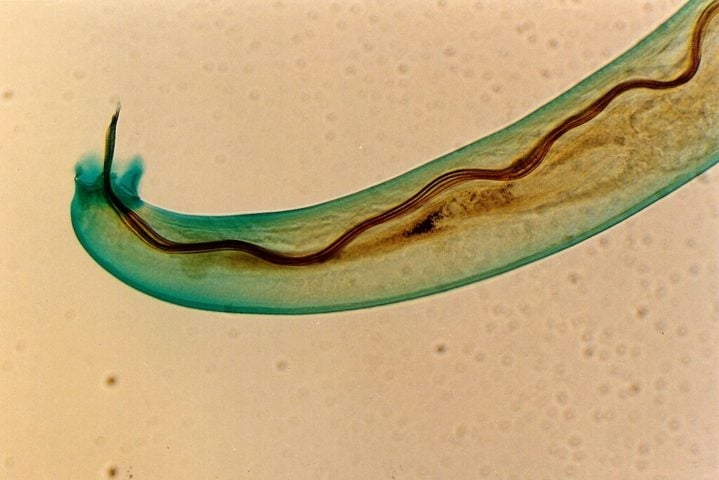 A causa foi a infecção pelo parasita Angiostrongylus cantonensis, conhecido como verme do pulmão de rato, comum em regiões tropicais e subtropicais.  Reprodução: Flipar