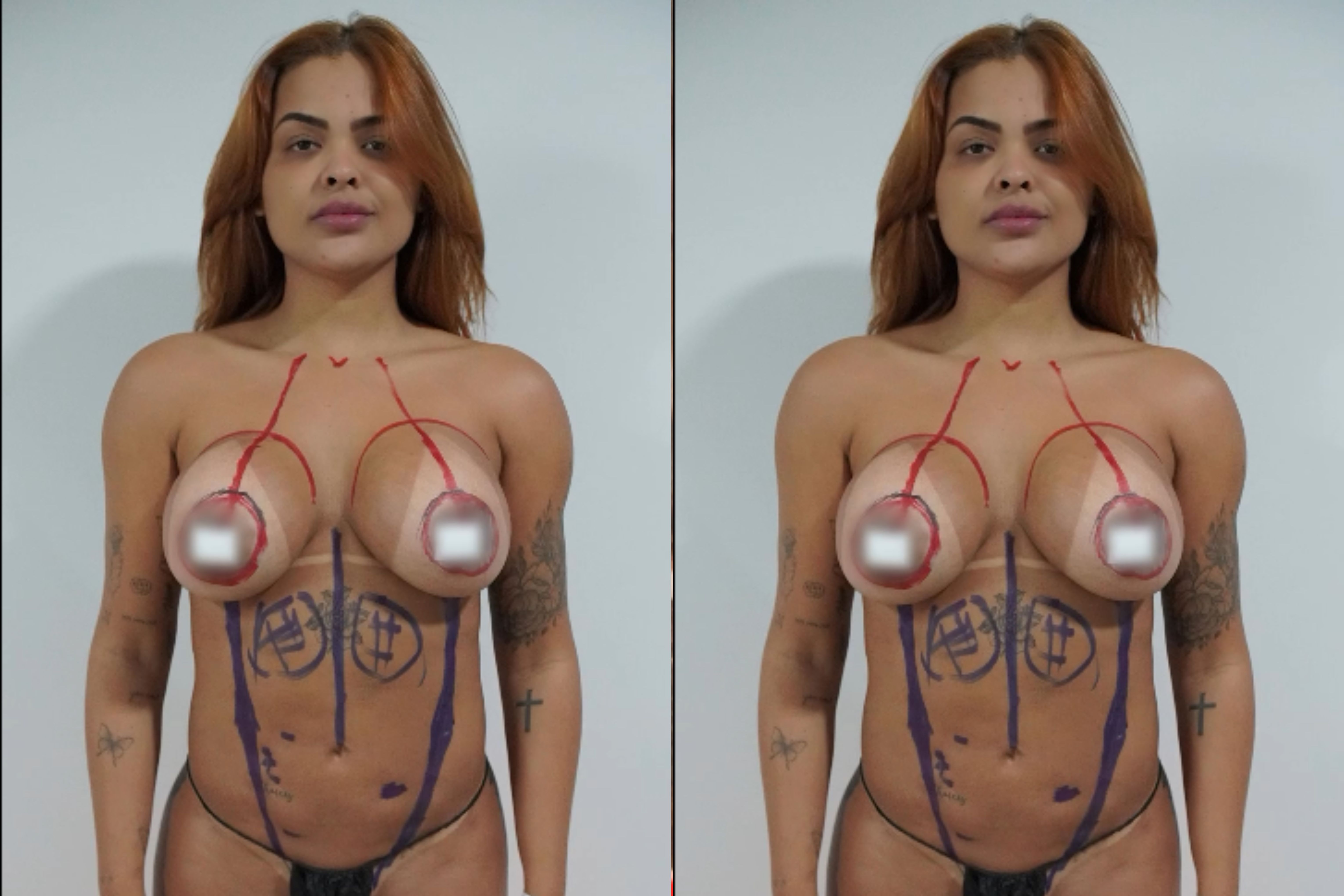 Paula Freitas, do BBB23, mostra resultados da cirurgia de redução de cintura Instagram