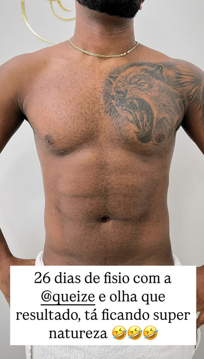 Corpo de Davi Brito após lipo HD. Foto: Reprodução: Instagram/@daviooficialll