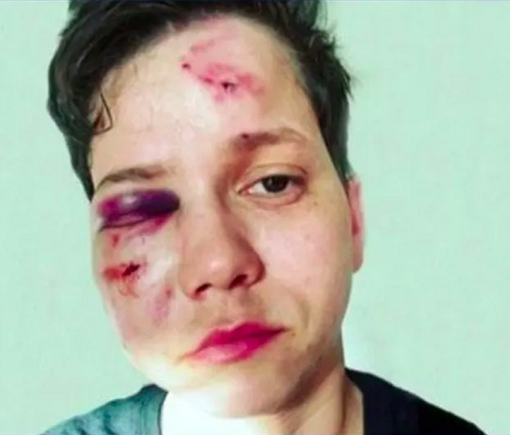 Em dezembro de 2019, Karol Eller sofreu uma agressão na Barra da Tijuca, no Rio de Janeiro, enquanto estava com a sua namorada.