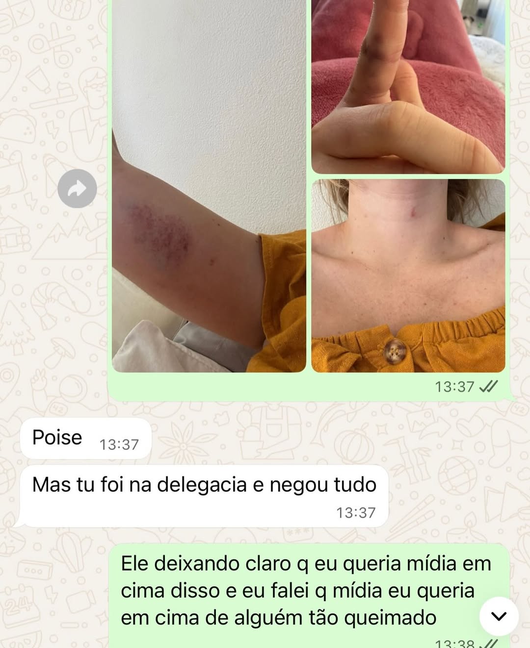 Marcela Tomaszewski postou prints e fotos de supostas agressões. Foto: Reprodução/ Instagram @tomaszewsk