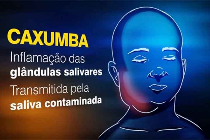 No caso de Rodrigo Faro, o chamado “bumbum de gaveta” - termo que ele usou para descrever a aparência menos arredondada dos glúteos - está relacionado a uma complicação rara da caxumba. Embora o vírus costume afetar as glândulas salivares, ele também pode provocar inflamações em outros tecidos, inclusive musculares. 
 Reprodução: Flipar