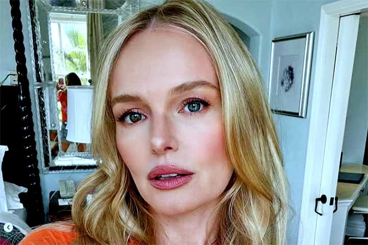 Kate Bosworth - A atriz californiana apresenta heterocromia parcial. O seu olho esquerdo é azul claro, enquanto o direito é composto por uma mescla de azul com tom castanho/avermelhado, formando um contraste marcante. 
 Reprodução: Flipar