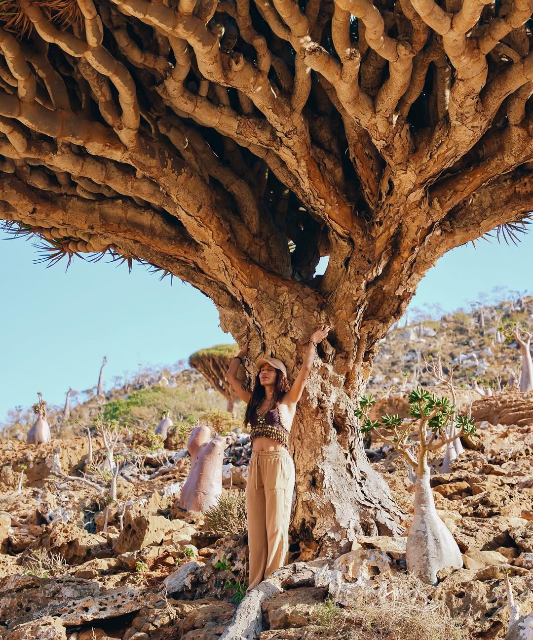 Anitta abraça árvore. Foto: Reprodução/ Instagram @Anitta