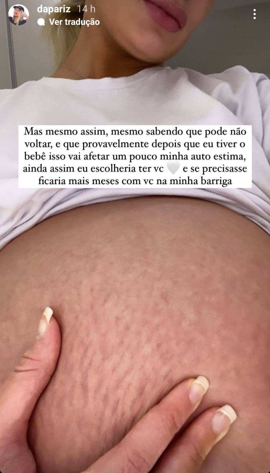 Stories de Dapariz falando sobre mudanças do corpo na gravidez. Foto: Reprodução/Instagram