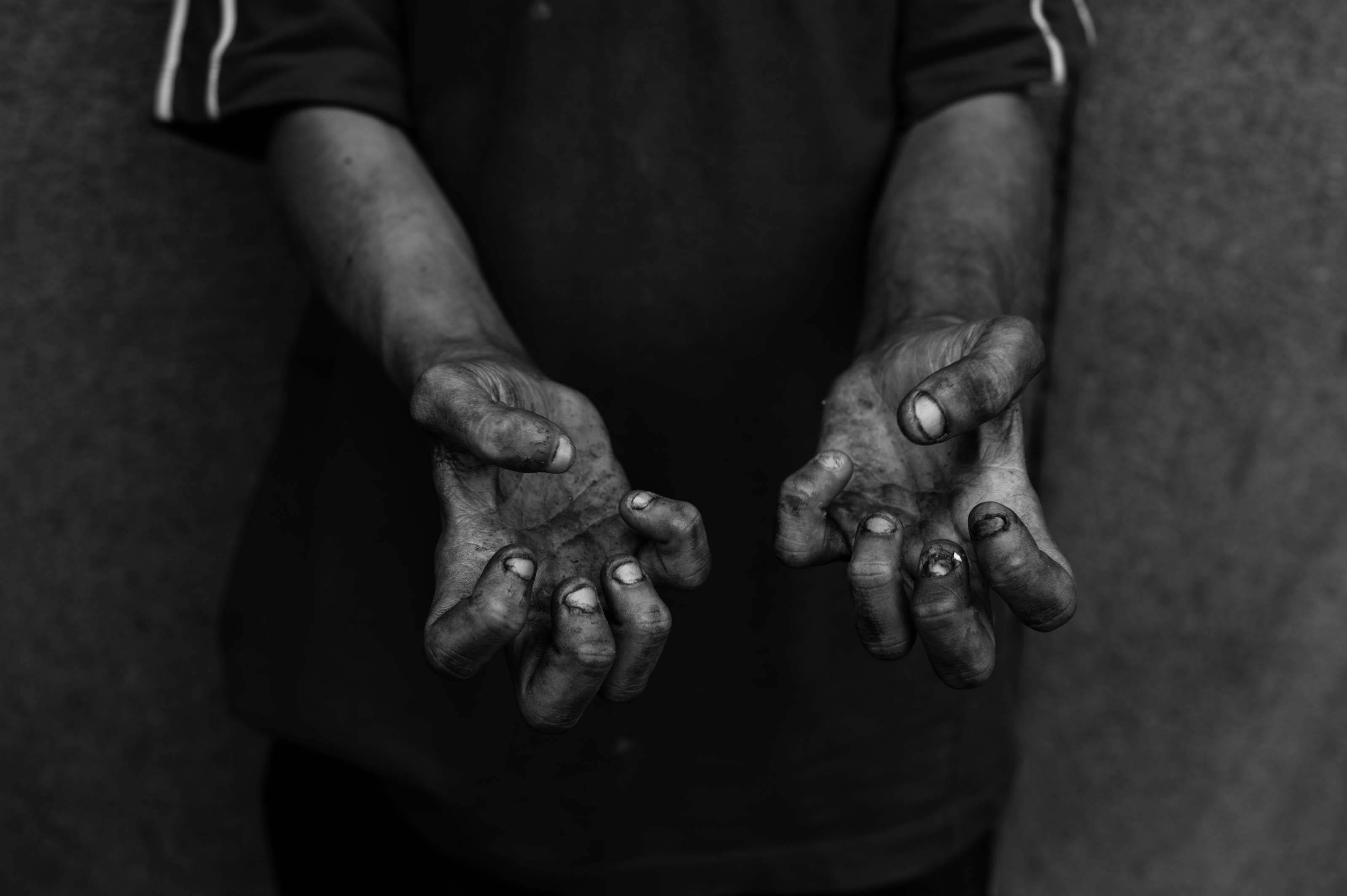 Já as mãos Pedro Enrique, de 18 anos, revelariam agressividade do jovem. Foto: Alessio Ortu/Simulacrum Praecipitii