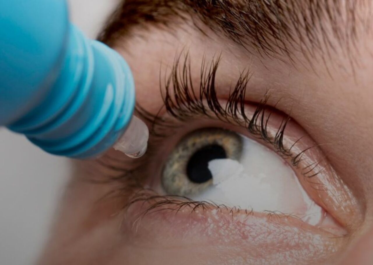 O alerta é sempre válido: qualquer ferimento no globo ocular oferece risco à visão. Qualquer coisa colocada nos olhos dependem de orientação médica.