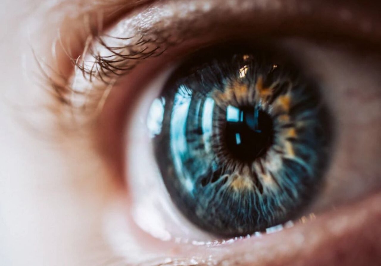 O melanoma ocular é um câncer nos melanócitos, células que dão cor aos olhos. É raro, mas é o tipo mais comum em adultos, especialmente a partir dos 45 anos. 