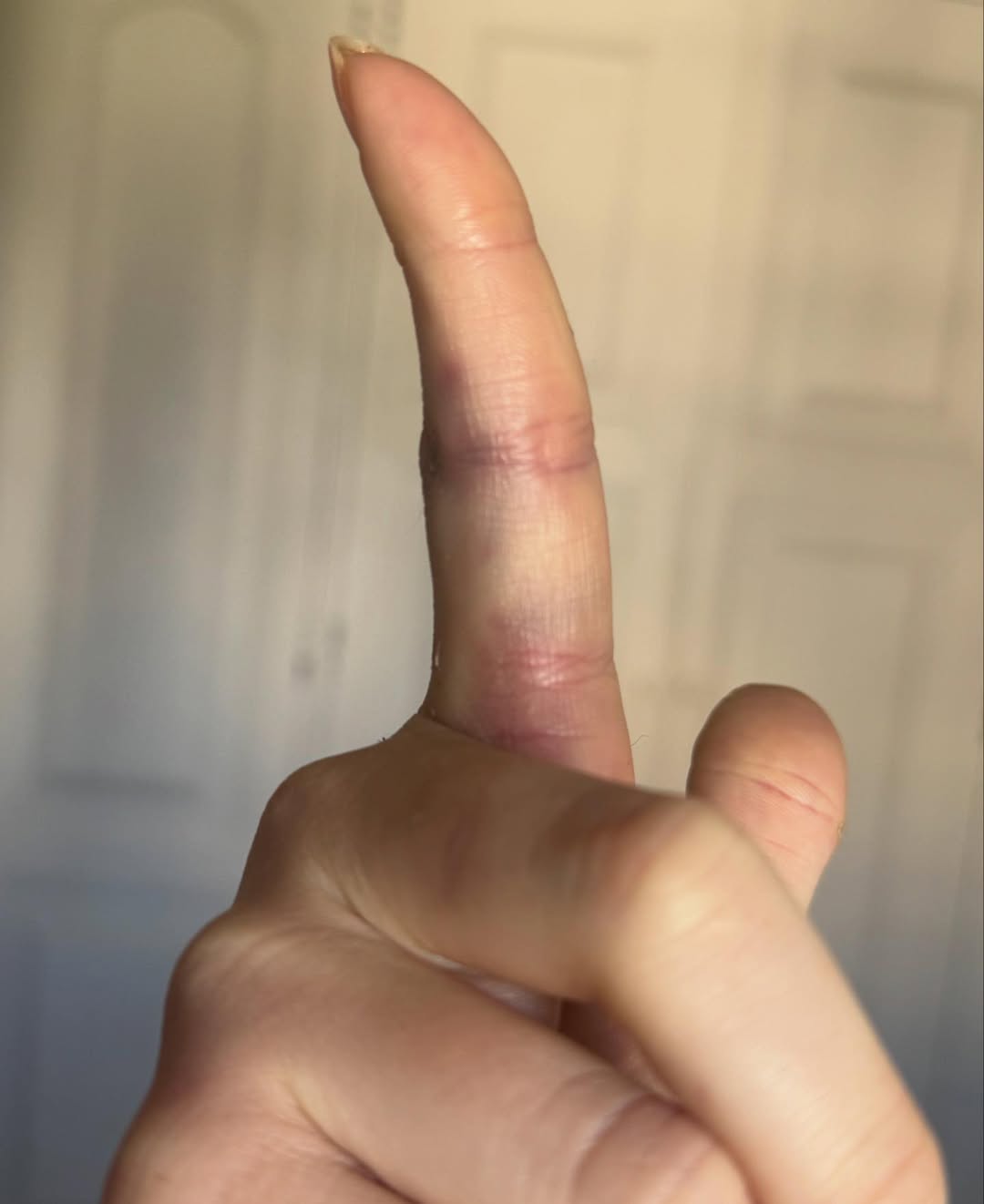 Marcela Tomaszewski postou prints e fotos de supostas agressões. Foto: Reprodução/ Instagram @tomaszewsk