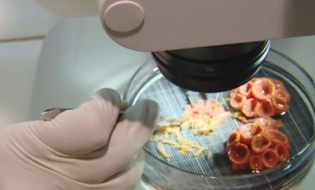 O material recolhido é levado para análise nos laboratórios na Universidade Federal de Santa Catarina (UFSC), que mantém parceria comInstituto Chico Mendes de Conservação da Biodiversidade (ICMBio). Reprodução: Flipar
