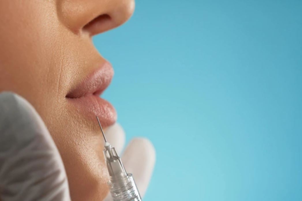 O processo leva de 30 a 60 minutos. Os resultados podem durar de um ano até a vida toda, dependendo do produto escolhido pelo profissional e pelo cliente. No início, há um inchaço na região, mas os resultados começam a aparecer logo depois. Reprodução: Flipar