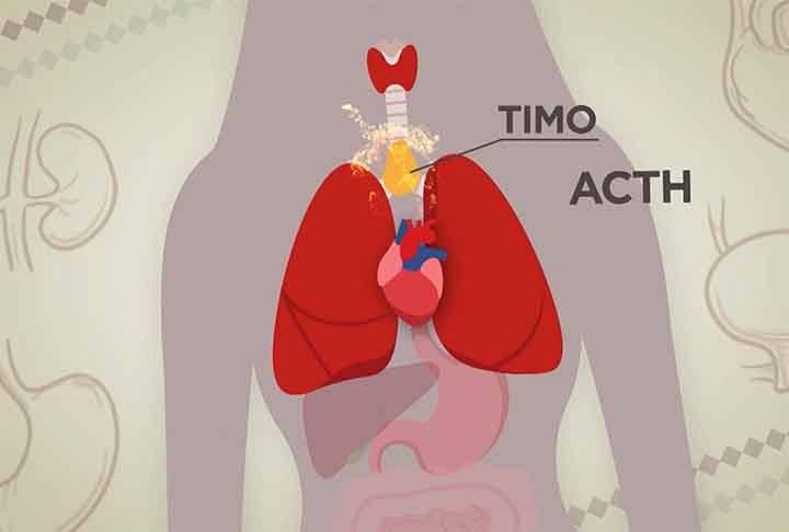 Para piorar o quadro, o tumor secreta o hormônio ACTH, que induz as adrenais a produzirem doses excessivas do hormônio cortisol. Essas glândulas estão situadas acima dos rins.
 Reprodução: Flipar