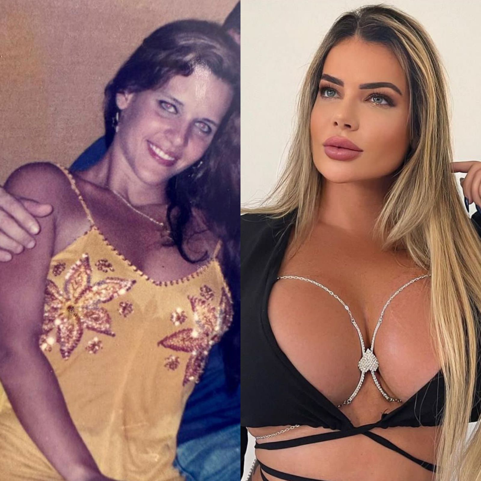 Denise Rocha choca com antes e depois