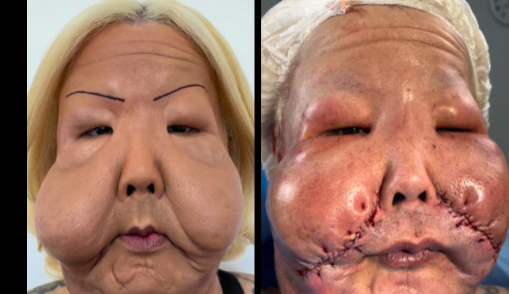 Juju do Pix passou por cirurgia. Foto: Reprodução/@drmarra