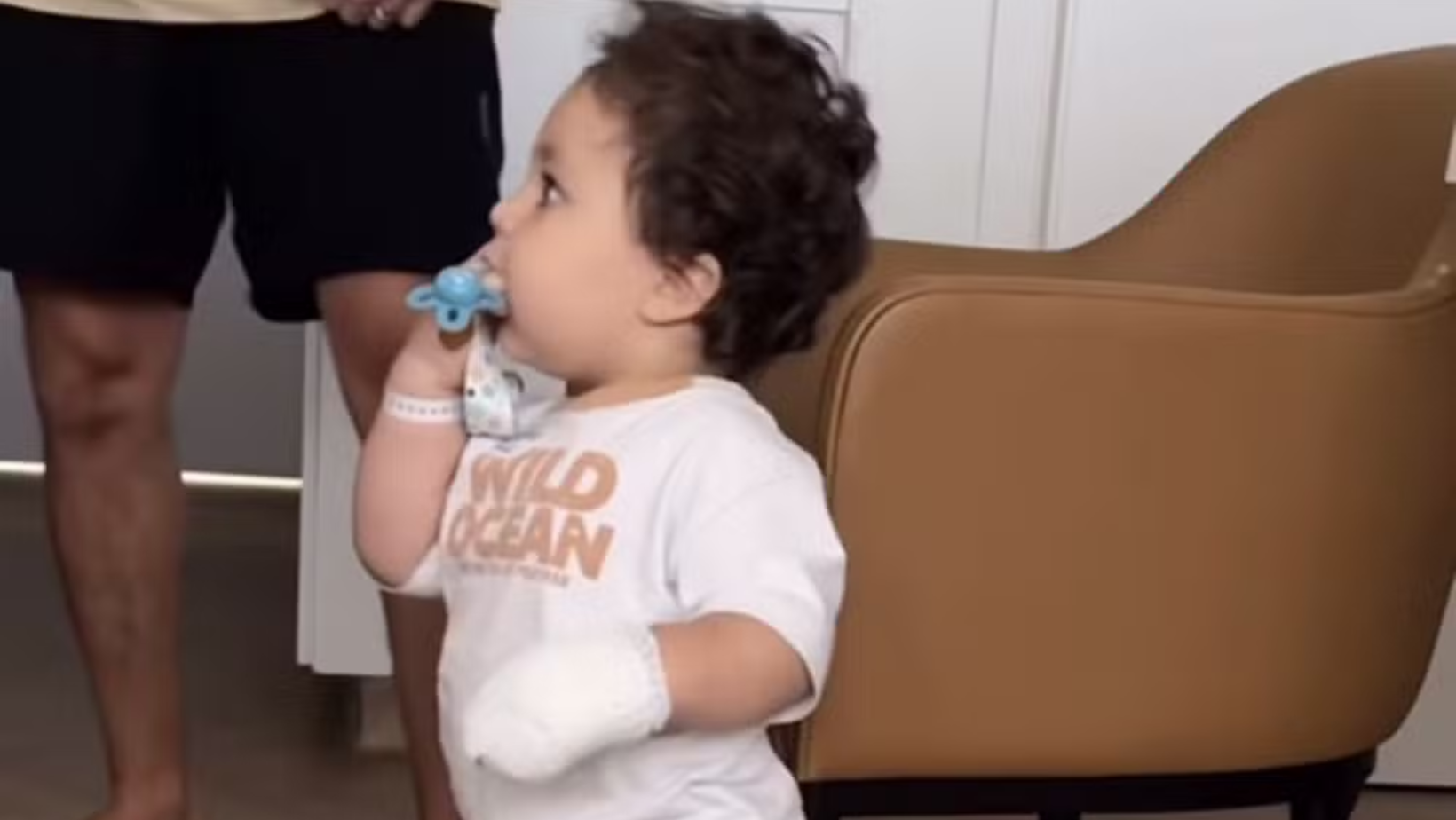 Ravi se recupera da queimadura. Foto: Reprodução/ Instagram @viihtube