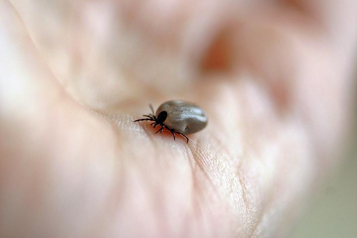 Depois, com uma pinça fina de ponta longa, segure o carrapato o mais próximo possível da pele do animal ou pessoa, agarrando-o pela cabeça. Reprodução: Flipar