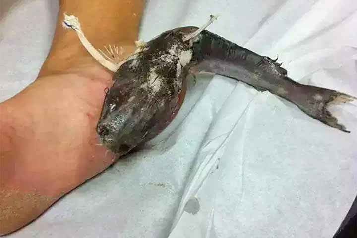 Diante disso, o alerta é para que banhistas evitem tocar nos animais, mesmo quando aparentam estar mortos.
 Reprodução: Flipar
