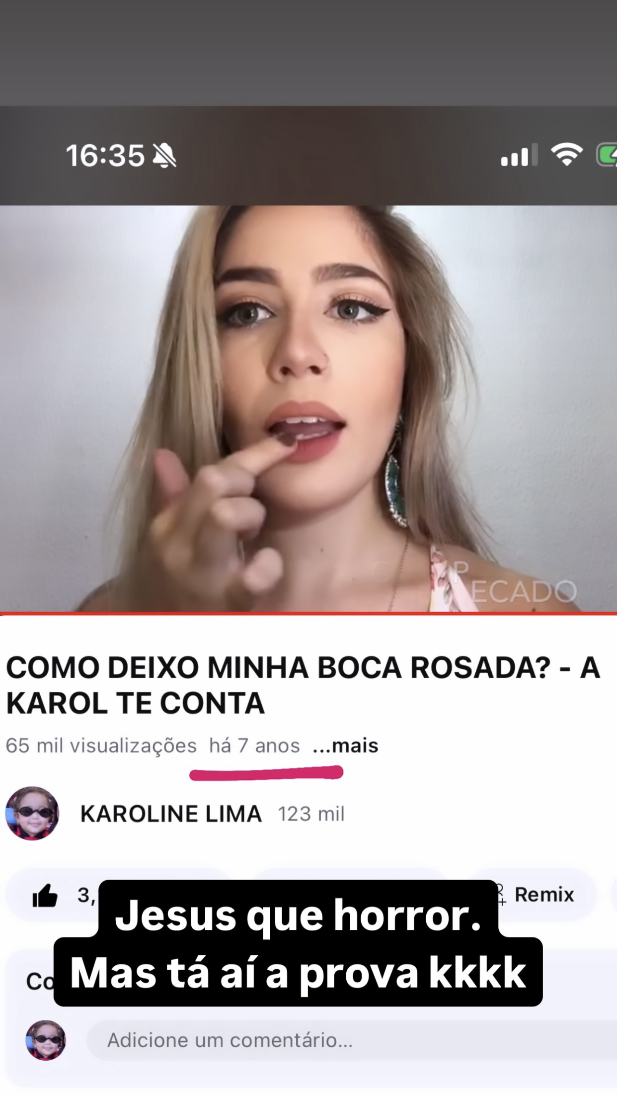 Karoline Lima surpreende com antes e depois dos procedimentos estéticos; veja Reprodução/Instagram