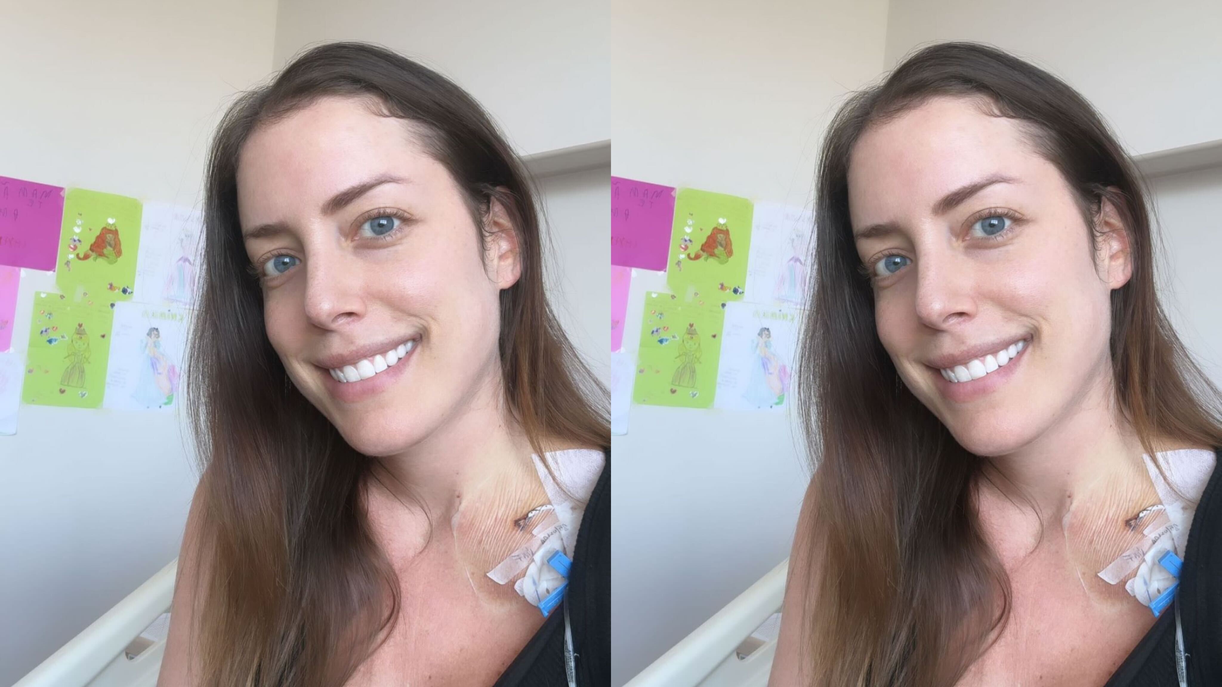 Fabiana Justus relata queda de cabelo em meio a tratamento contra câncer Reprodução Instagram - 30.1.2024