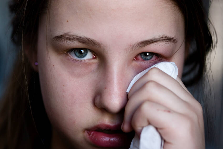 A conjuntivite parece ser uma consequência desse do zika vírus e está menos presente nas outras doenças iStock